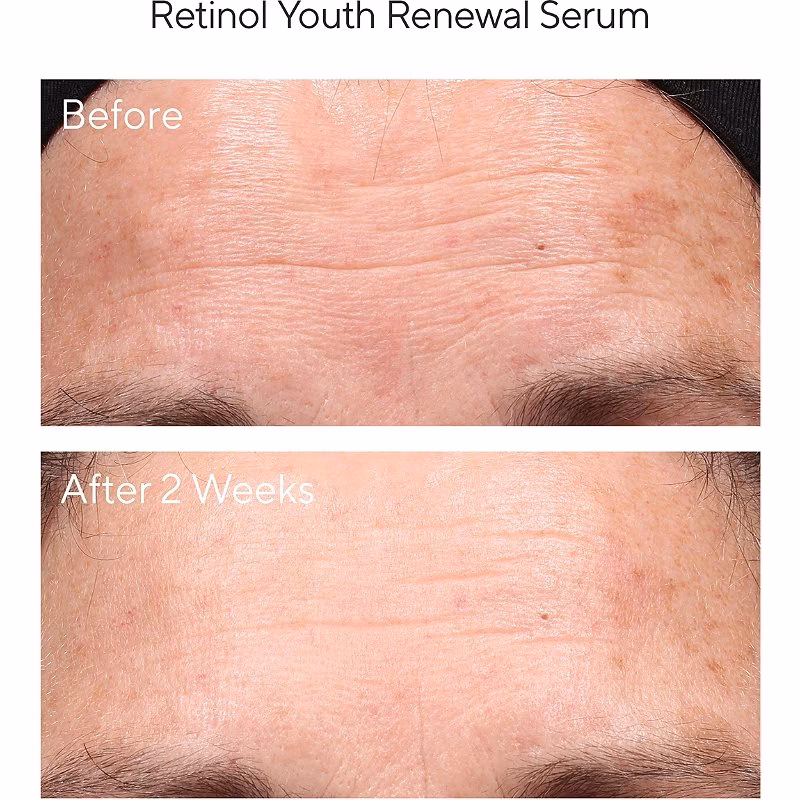 کرم شب رتینول مورد Murad Retinol Youth Renewal Night Cream — تصویر ۷