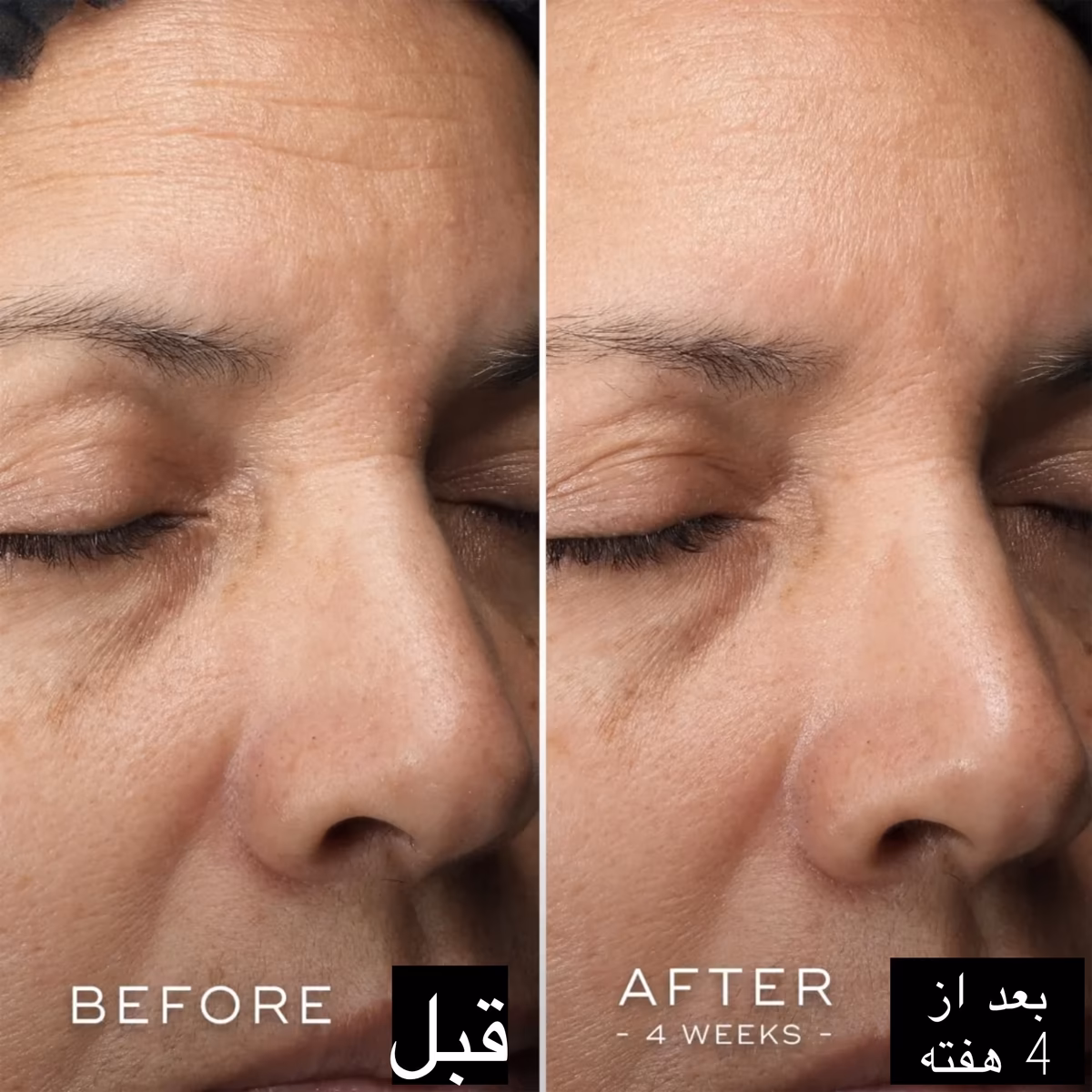سرم ویتامین C مدیک8 C-Tetra Luxe | روشن‌کننده، ضدچروک و آنتی‌اکسیدان لوکس — تصویر ۵