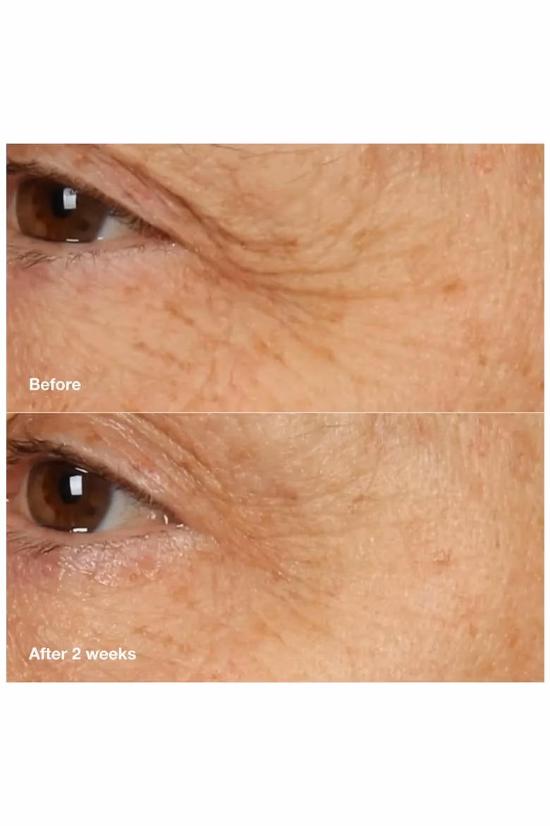 پک دوتایی دور چشم ضد چروک اسمارت کلینیک (Clinique Smart Clinical Repair Eye Cream Duo Set) — تصویر ۵