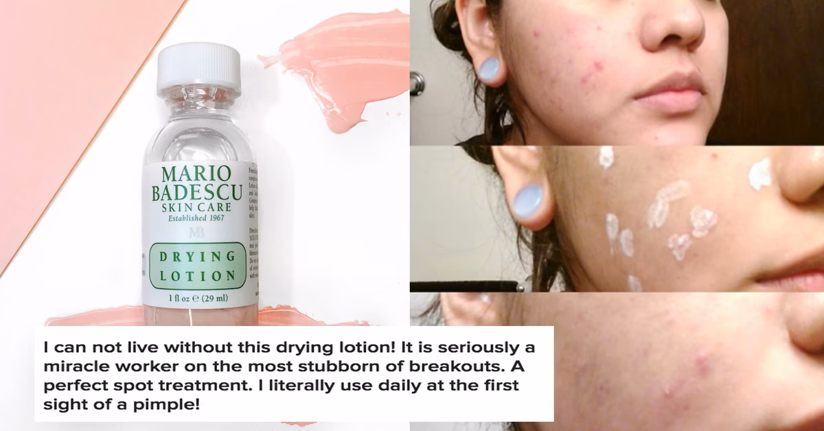 لوسیون ضدجوش اورژانسی ماریو بادسکو (Mario Badescu Drying Lotion) — تصویر ۷