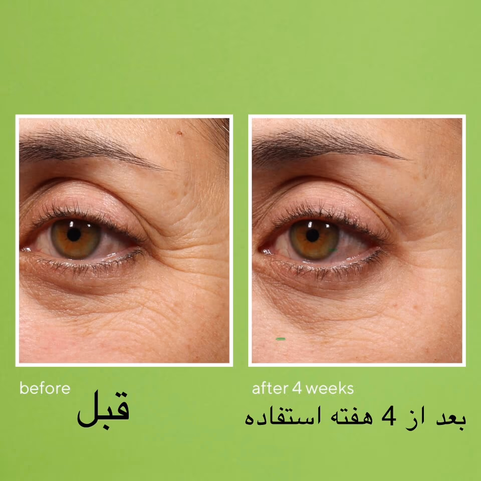 سرم دور چشم رتینول Murad Retinol Youth Renewal Eye Serum — تصویر ۶