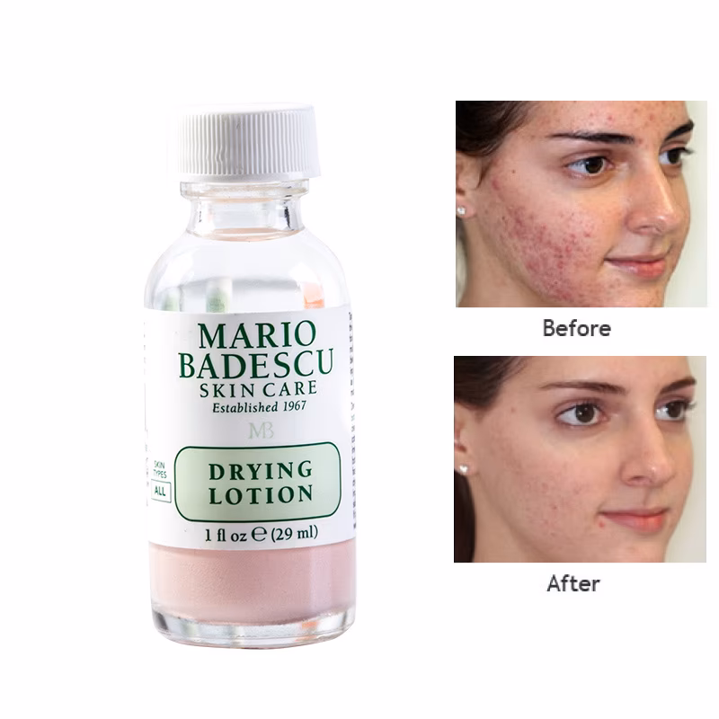 لوسیون ضدجوش اورژانسی ماریو بادسکو (Mario Badescu Drying Lotion) — تصویر ۸