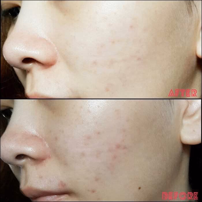 سرم استی لادر Advanced Night Repair (نسل جدید) | انقلابی در جوانسازی و ترمیم پوست — تصویر ۴