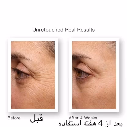 سرم دور چشم رتینول Murad Retinol Youth Renewal Eye Serum — تصویر ۸