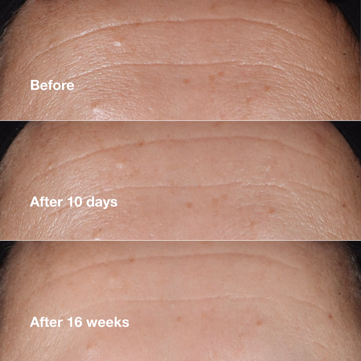 سرم ضد چروک کلینیک (Clinique Smart Clinical Repair Wrinkle Correcting Serum)