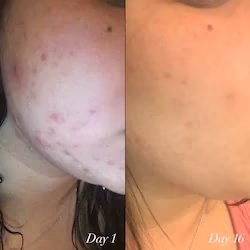 سرم جوانساز و ضد لک شانی داردن (Shani Darden Retinol Reform) مینی سایز 5 میل — تصویر ۴