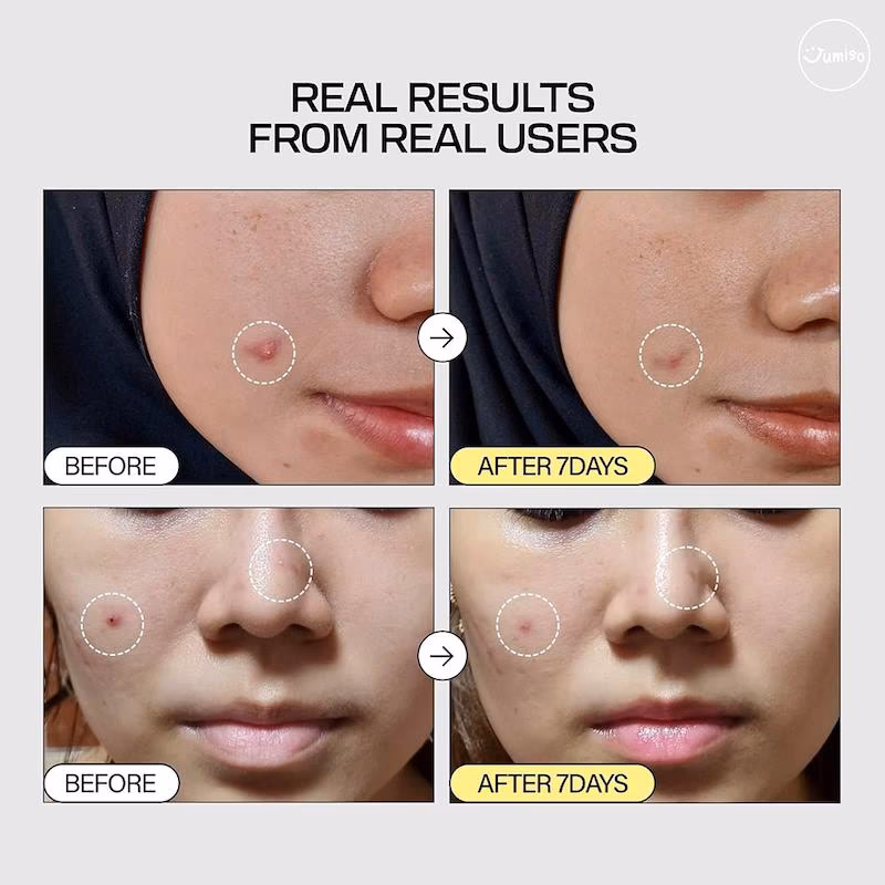 اسنس حلزون جومیسو JUMISO Snail Mucin 95% + Peptide Facial Essence — تصویر ۲