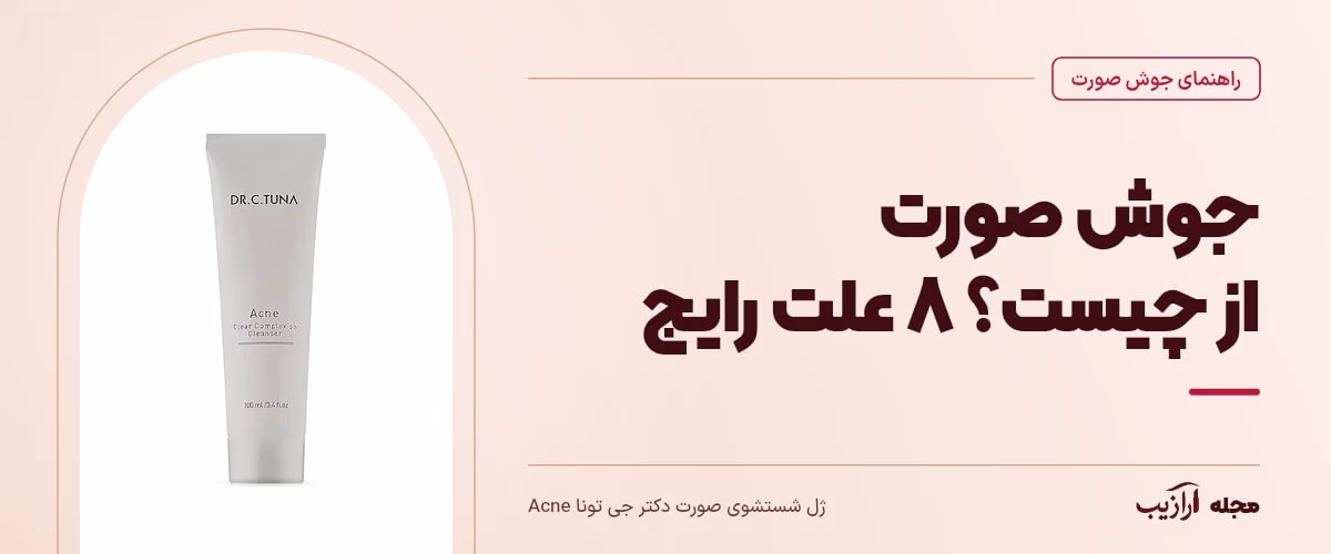 جوش صورت از چیست؟ ۸ علت رایج — ژل شستشوی صورت دکتر جی تونا Acne، از محصولات مرتبط با جوش صورت