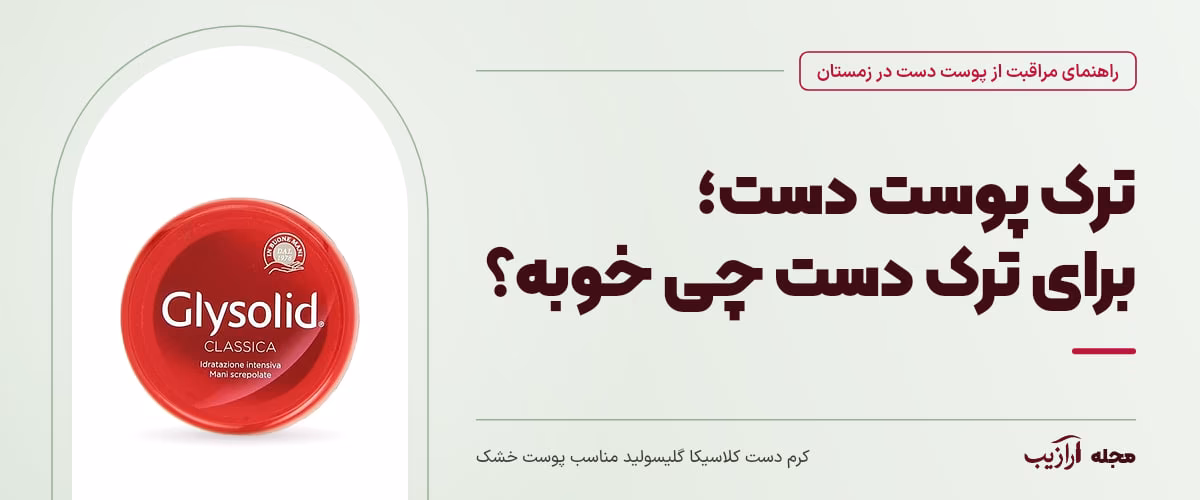 ترک پوست دست؛ برای ترک دست چی خوبه؟ — کرم دست کلاسیکا گلیسولید مناسب پوست خشک، از محصولات مرتبط با مراقبت از پوست دست در زمستان