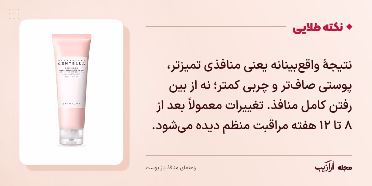 نکته طلایی منافذ باز پوست: نتیجهٔ واقعبینانه یعنی منافذی تمیزتر، پوستی صافتر و چربی کمتر؛ نه از بین رفتن کامل منافذ. تغییرات معمولاً بعد از ۸ تا ۱۲ هفته مراقبت منظم دیده میشود.
